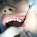 Photo Dental braces